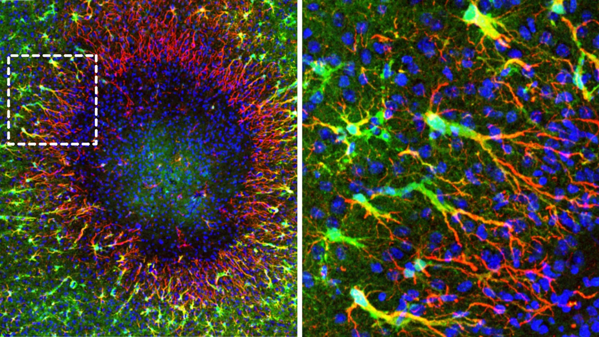 Adult Brain Can Repair Itself by Moving Cell Nuclei Into Damaged Tissue