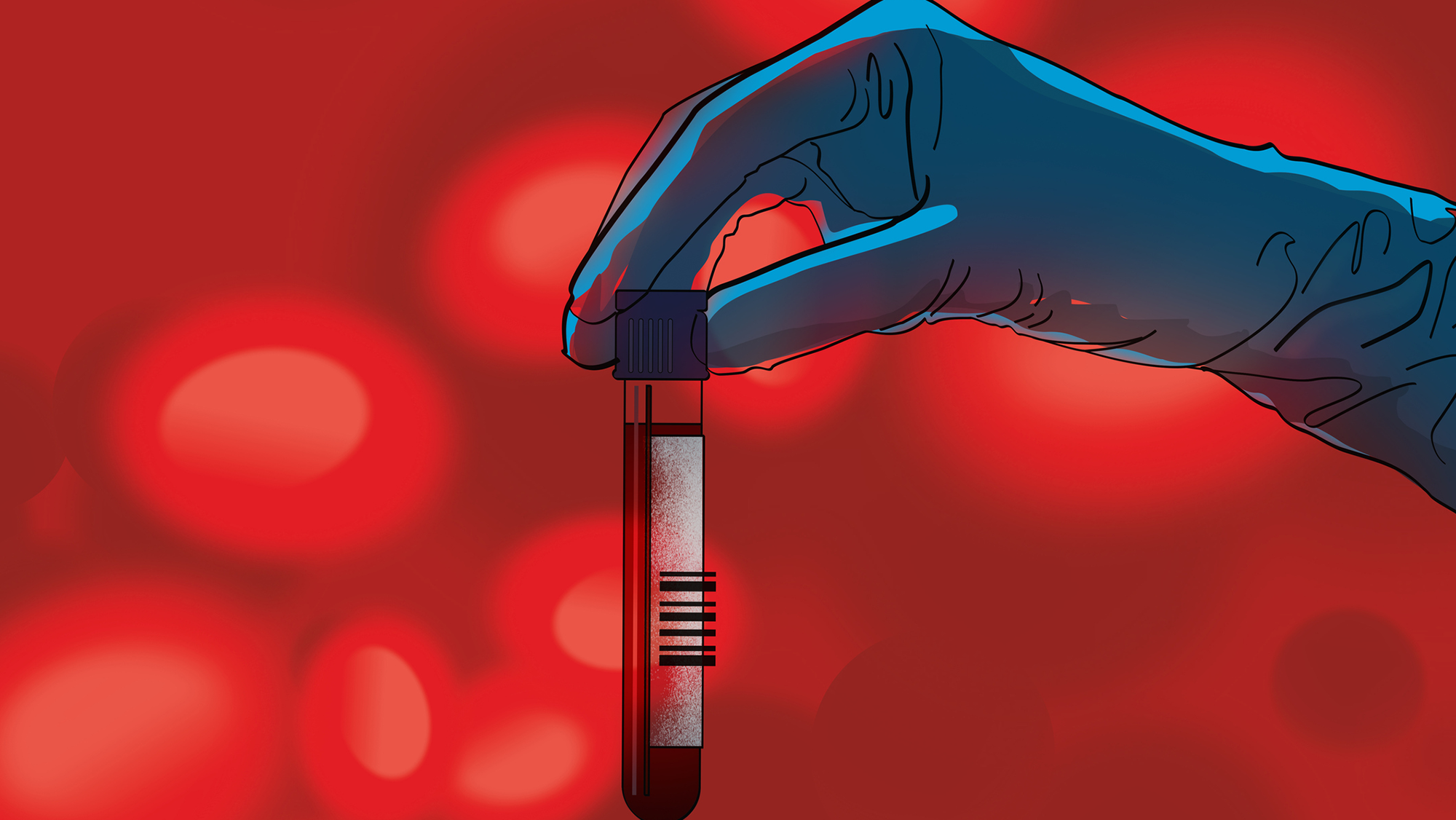 Alzheimer's Blood Tests Are Transforming How Patients Get Diagnosed