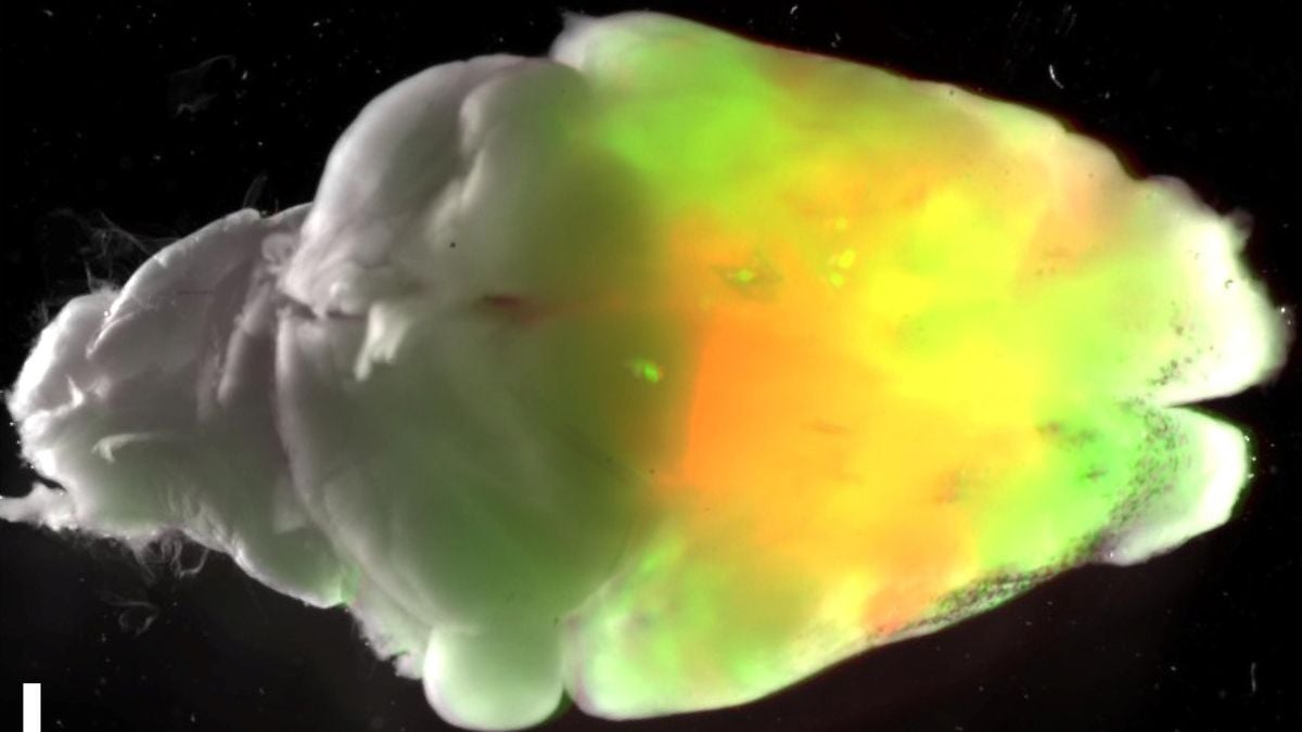 Human Brain Tissue Grown Inside Mice Integrates With Their Nervous Systems