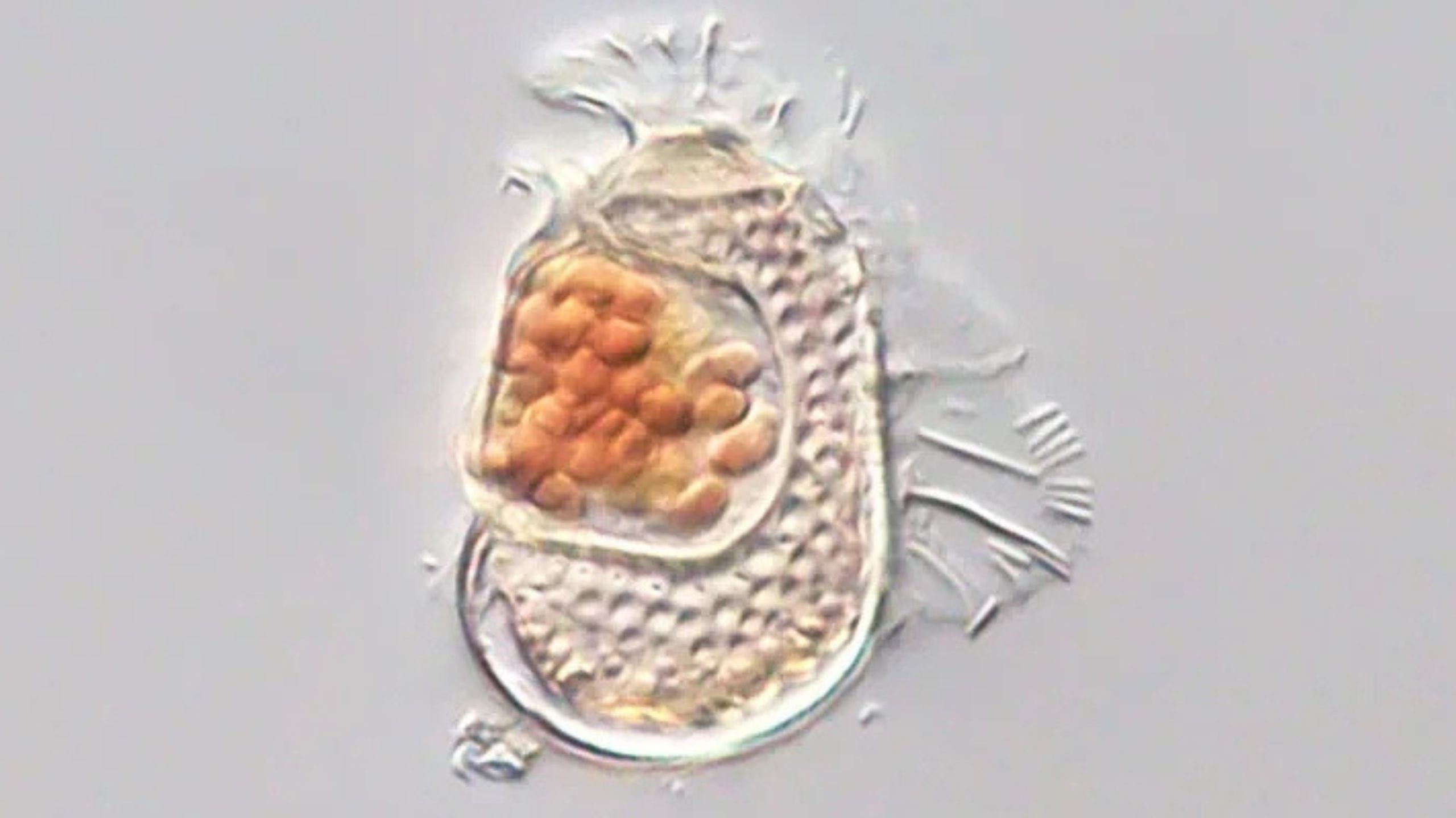 Microbe With One of the Smallest Genomes Ever Found Challenges Definition of Life